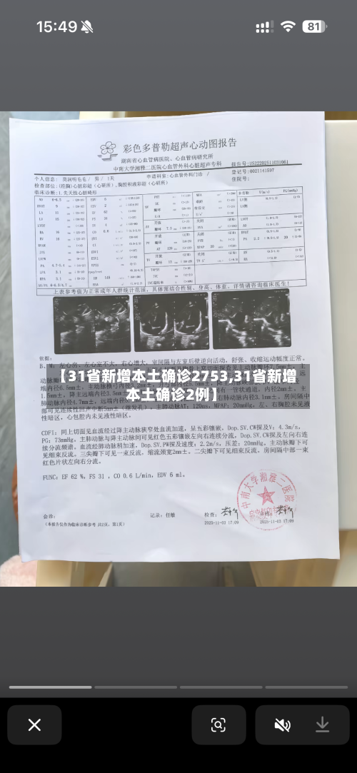 【31省新增本土确诊2753,31省新增本土确诊2例】