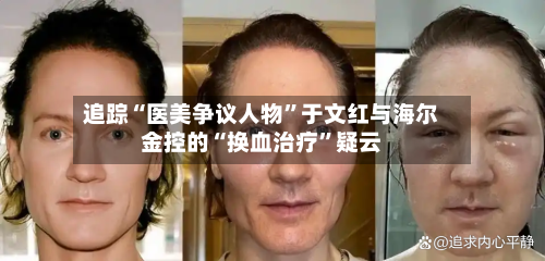 追踪“医美争议人物”于文红与海尔金控的“换血治疗	”疑云-第3张图片